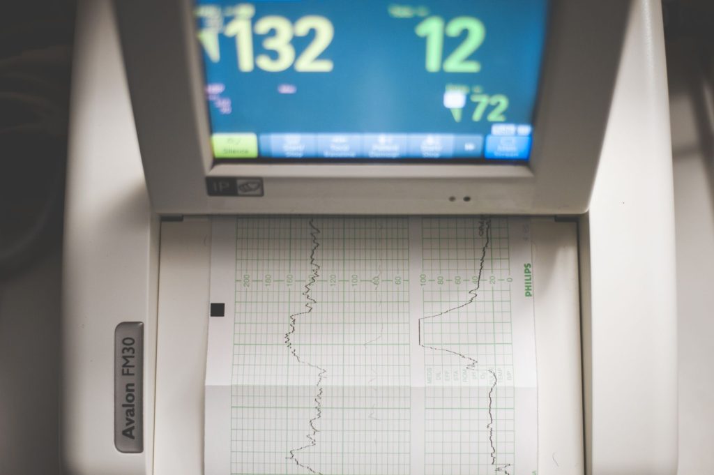 electrocardiogram medical screen