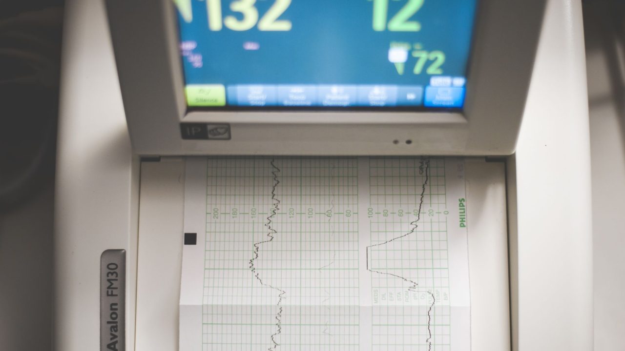 electrocardiogram medical screen