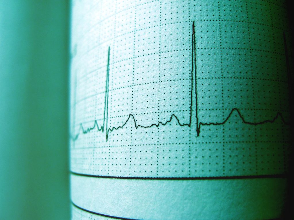 medical parameters heart rate