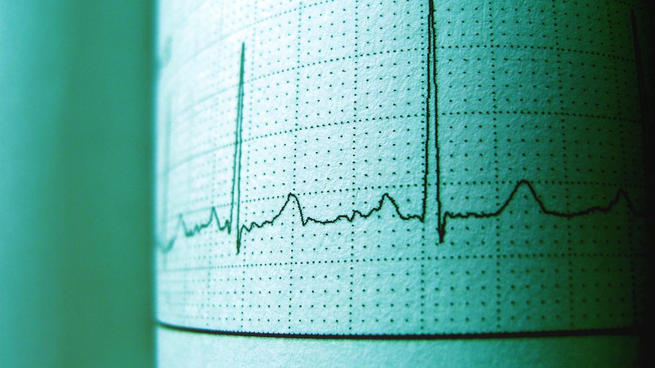 Pengenalan dan Fungsi Utama Patient Monitor